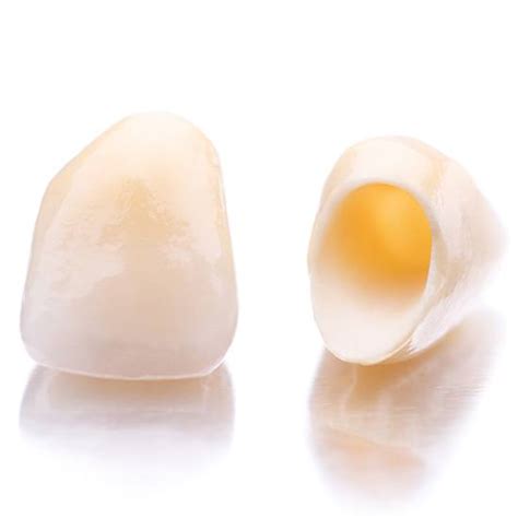 dental crowns arvada|Dental Crowns in Arvada, CO .